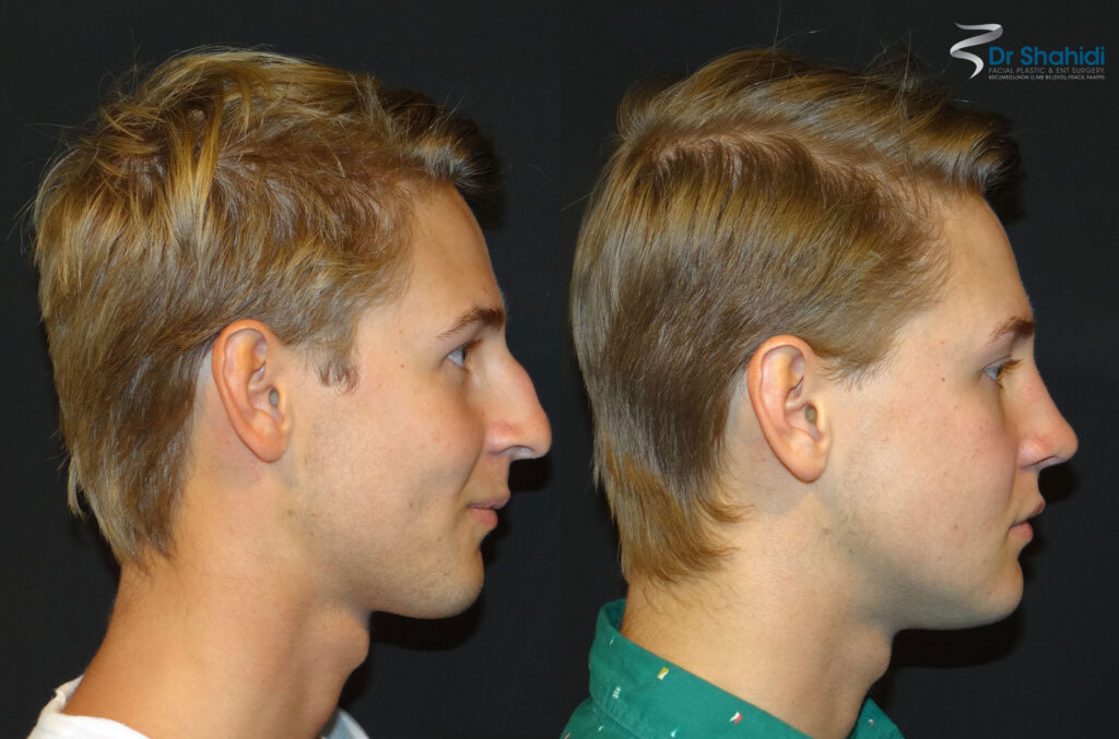 Tim-side-BA - Dr Shahidi