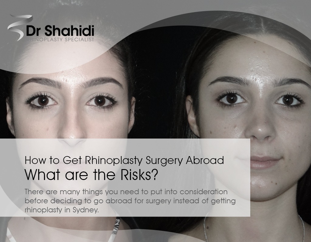 How to Get Rhinoplasty Surgery Abroad - What are the Risks
